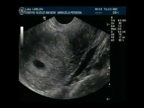 Aumente o SOM!) VOU SER TITIA !!! ULTRA 6 semanas de gestação da ... Aumente o SOM!) VOU SER TITIA !!! ULTRA 6 semanas de gestação da ...