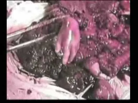 Barack Obama Apoya el Holocausto de Bebes No Nacidos - YouTube Barack Obama Apoya el Holocausto de Bebes No Nacidos - YouTube