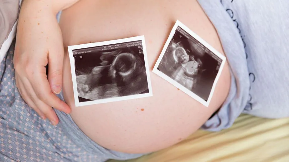Barriga en el embarazo gemelar - Cuando Pares a Pares Barriga en el embarazo gemelar - Cuando Pares a Pares