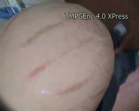 barriga mellizos 33 semanas - YouTube