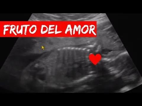 MI BEBE A LOS 20 SEMANAS Y 2 DIAS O 5 MESES - YouTube