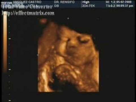 Mi bebe en 35 semanas eco 3D - YouTube