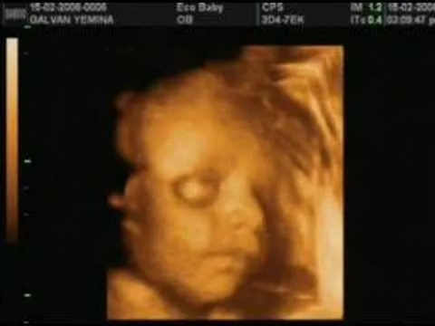 Bebe Galvan-Maida - Eco 3D - Febrero 2008 - YouTube