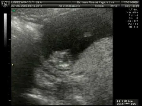 Mi bebe a 3 meses de embarazo, Ara y Roman - YouTube Mi bebe a 3 meses de embarazo, Ara y Roman - YouTube