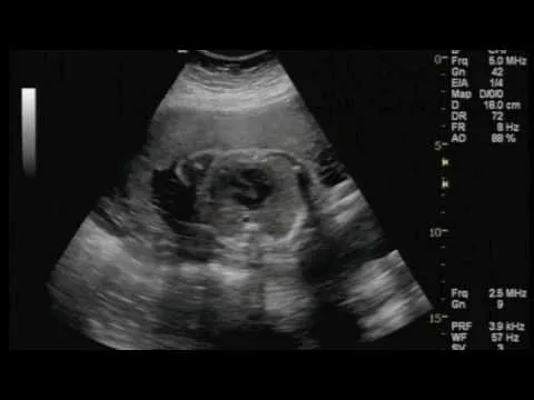 Mi bebe a los 7 meses de embarazo - YouTube Mi bebe a los 7 meses de embarazo - YouTube
