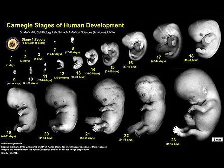 Como esta un bebé de 5 meses de gestacion - Imagui