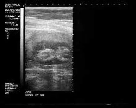 mi bebe a los tres meses de gestacion - YouTube mi bebe a los tres meses de gestacion - YouTube