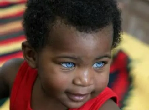 NIÑO DE COLOR OSCURO CON OJOS AZULES !! INCREIBLE PERO CIERTO ...