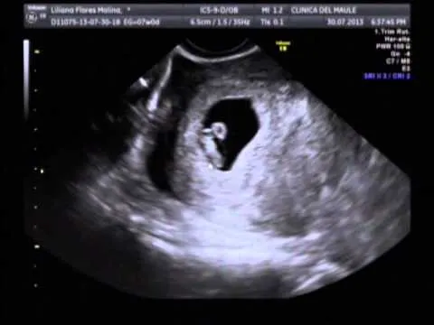 mi bebe con sus 7 semanas y 3 dias de vida - YouTube mi bebe con sus 7 semanas y 3 dias de vida - YouTube