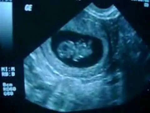 Mi bebe de 9 semanas - YouTube