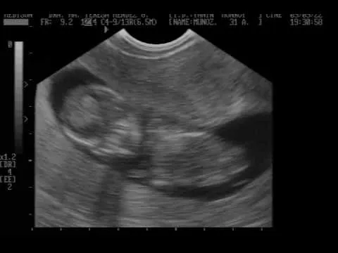 Nuestro Bebe Yanin & Gustavo 13 semanas de embarazo - YouTube Nuestro Bebe Yanin & Gustavo 13 semanas de embarazo - YouTube