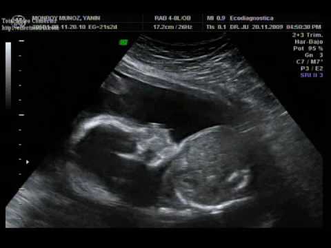 Bebe Yanin Gustavo 3D 21 Semanas de Embarazo - YouTube Bebe Yanin Gustavo 3D 21 Semanas de Embarazo - YouTube