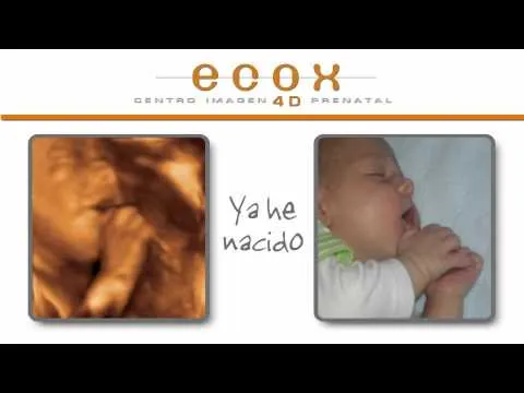 Los bebés antes y después de nacer | Pequelia
