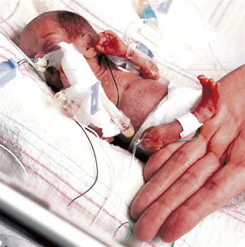 bebes prematuros, sietemesion, seismesino | elembarazo.net