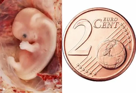 Embrión de 9 semanas - Imagui