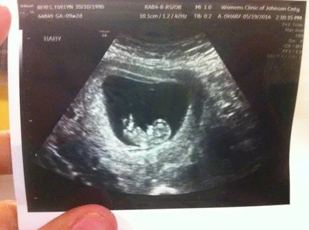 Mi bebesote a las 13 semanas - Bebés de Diciembre 2014 - Página 2 ... Mi bebesote a las 13 semanas - Bebés de Diciembre 2014 - Página 2 ...