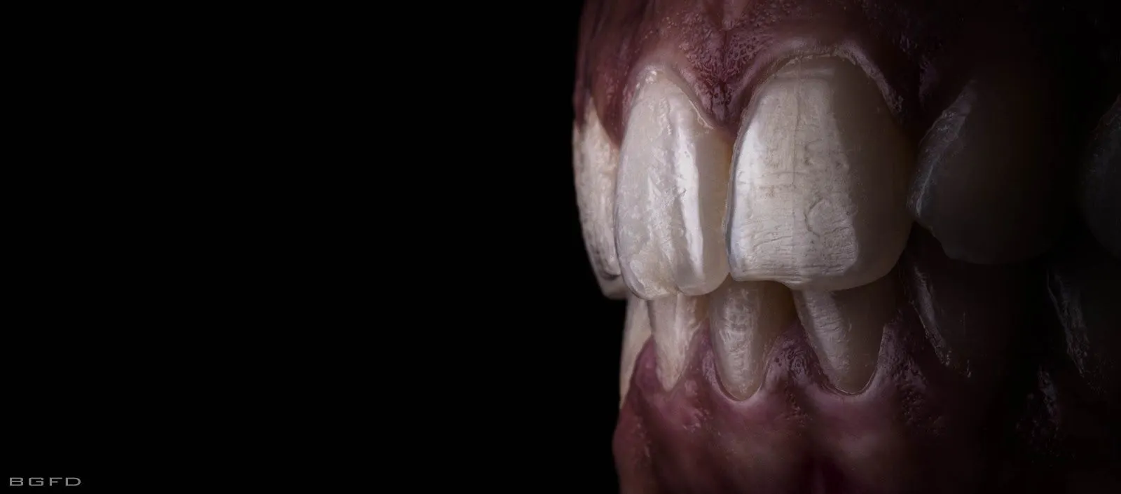 BG Fotografía Dental