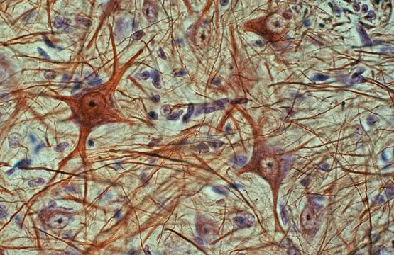 BIOLOGÍA 2do: EL TEJIDO NERVIOSO