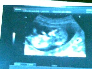 bebe de 6 meses en la barriga