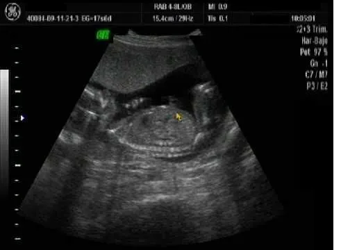 El Blog De Santiago Emiliano..: noviembre 2010