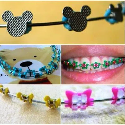 Borrachinha de aparelho do Mickey e da Minnie | Braces | Pinterest ...