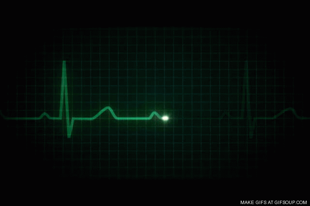 Gif animado EKG - Imagui