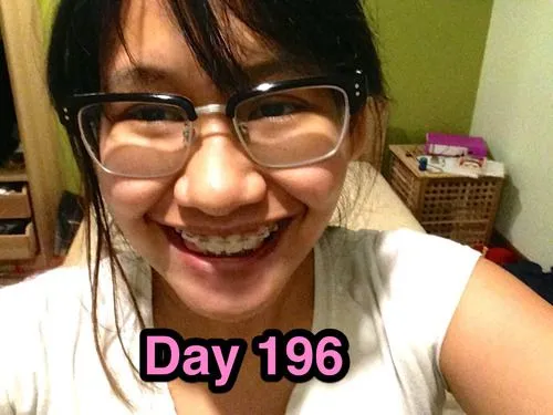 Braces Diary: Brace Yourself - Day 196: Thoughts - Day 196: Thoughts Braces Diary: Brace Yourself - Day 196: Thoughts - Day 196: Thoughts