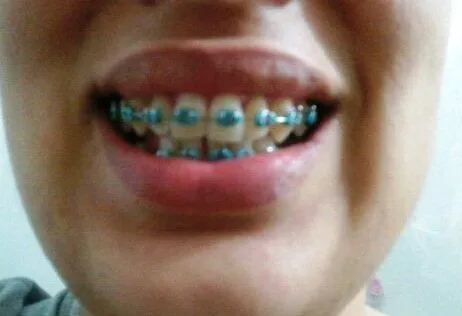 Brackets color azul - Imagui
