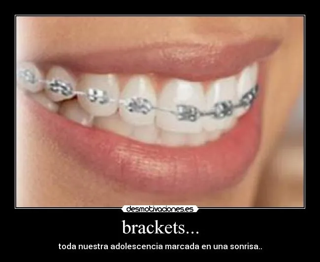 brackets... | Desmotivaciones