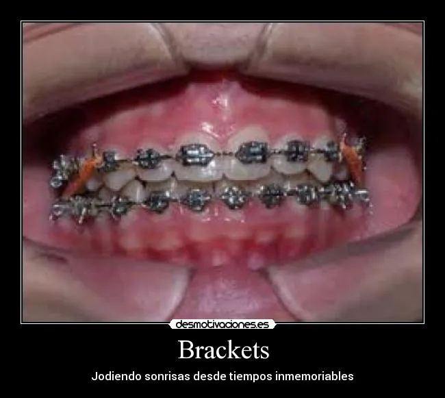 Brackets | Desmotivaciones
