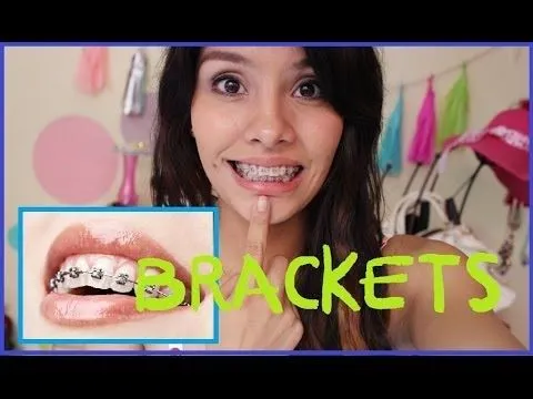 BRACKETS - Mi experiencia, Consejos - YouTube