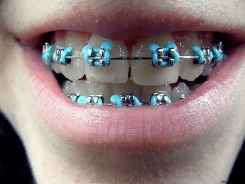 Brackets de Mickey Mouse - Imagui