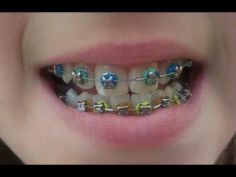 Brackets Paso a Paso - Ma01rp - YouTube