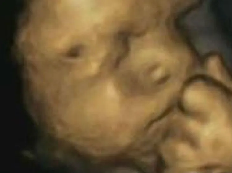 Esta es la cara de preocupación de un feto cuando su mamá está ... Esta es la cara de preocupación de un feto cuando su mamá está ...