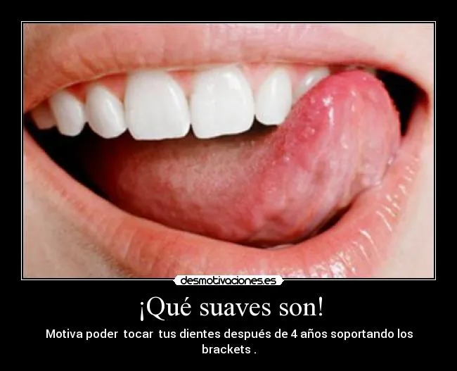 Carteles de Brackets | Desmotivaciones