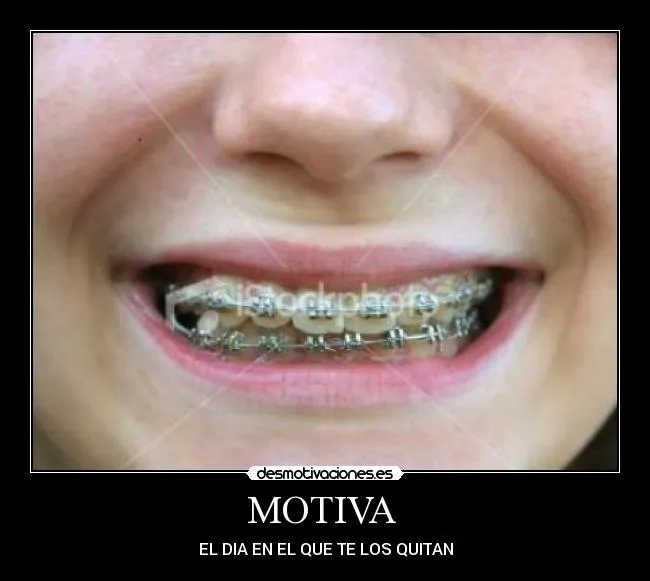 Carteles de Brackets | Desmotivaciones