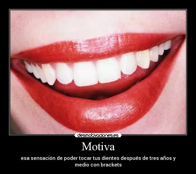 Carteles de Brackets | Desmotivaciones