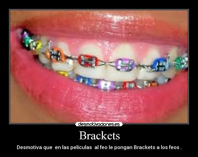 Carteles de Brackets Pag. 5 | Desmotivaciones