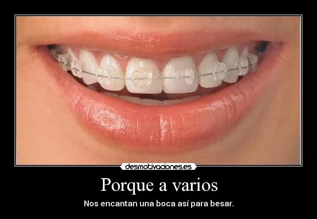 Carteles de Brackets Pag. 5 | Desmotivaciones