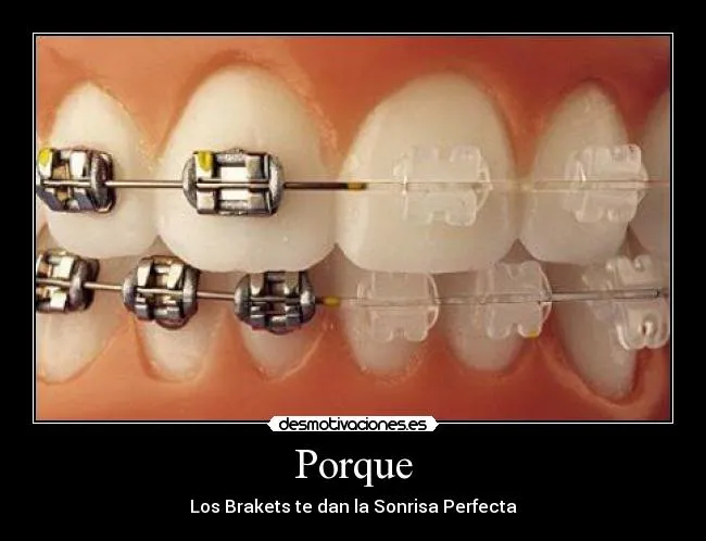 Carteles de Brakets | Desmotivaciones