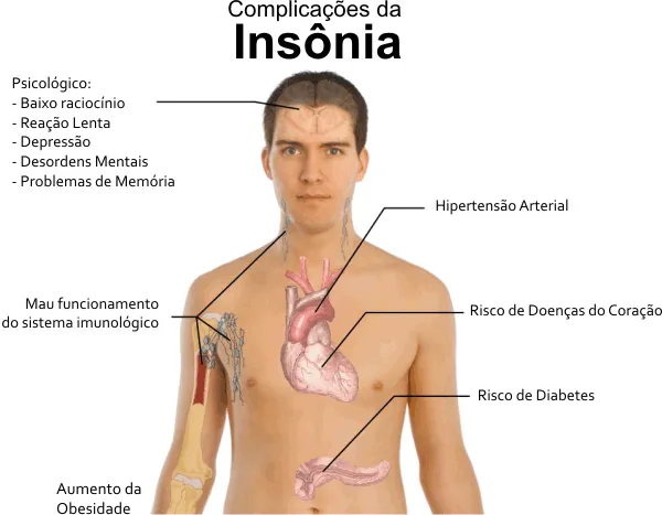 Centro de Estudos em Farmacovigilância da UNIFAL: Insônia e o uso ...