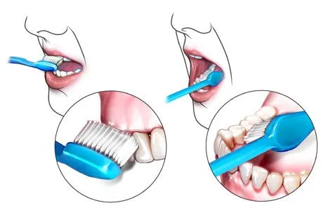 Como cepillarse los dientes. | Clinica Dental Jerez Como cepillarse los dientes. | Clinica Dental Jerez