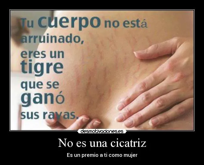 No es una cicatriz | Desmotivaciones