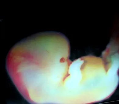 Ciencias Naturales Online » Desarrollo del feto 9 meses