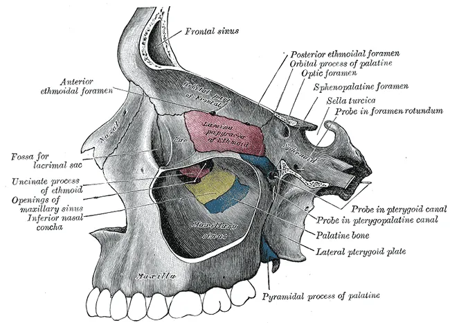 CIRUGIA ORAL Y MAXILOFACIAL EN COLOMBIA: ELEVACION DE SENO MAXILAR ...