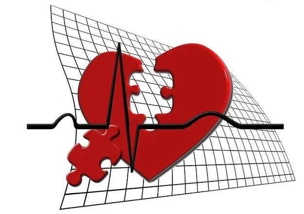 Ecg | Fotos y Vectores gratis
