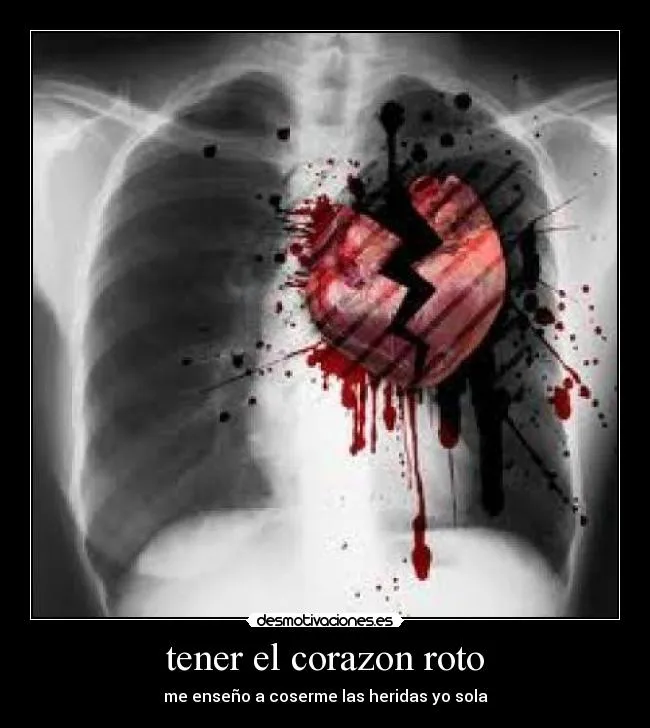tener el corazon roto | Desmotivaciones