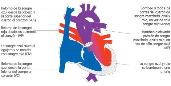 Corience: Tronco arterial (o tronco arterial común)