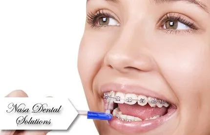 Corrige tu sonrisa! Paga RD$ 4,950 en vez de RD$ 25,000 por Kit de ... Corrige tu sonrisa! Paga RD$ 4,950 en vez de RD$ 25,000 por Kit de ...