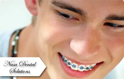 Corrige tu sonrisa! Paga RD$ 4,950 en vez de RD$ 25,000 por Kit de ... Corrige tu sonrisa! Paga RD$ 4,950 en vez de RD$ 25,000 por Kit de ...